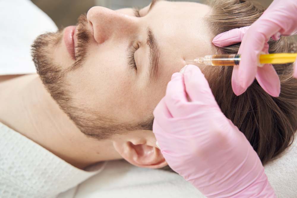 PRP facial